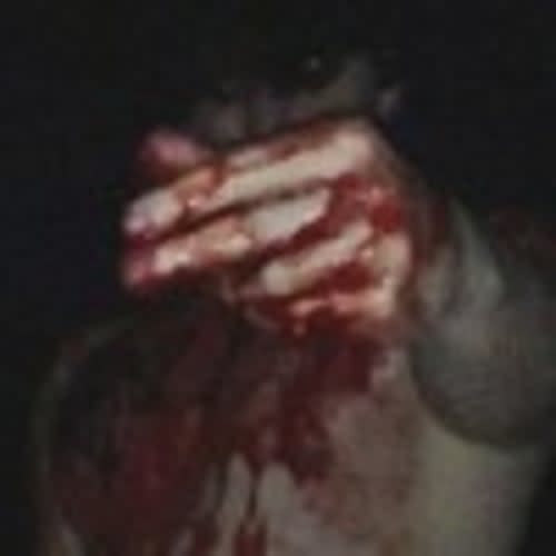 STVG