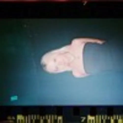 ESC